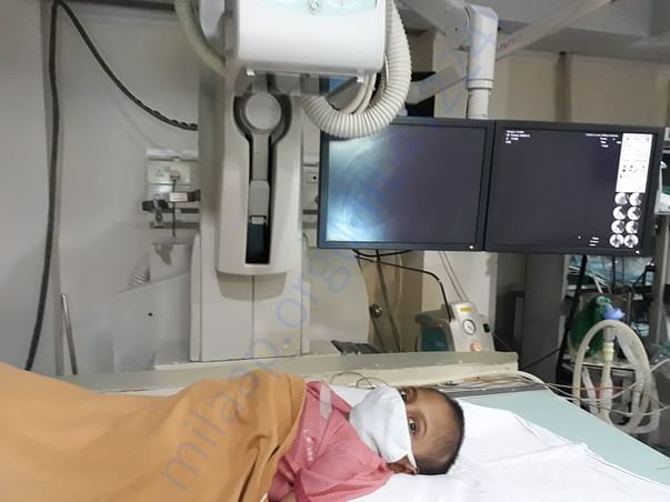 ERCP PROCEDURE ROOM
